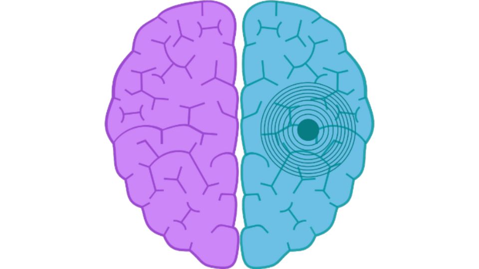 Epilepsi görseli - DrCem hastalık rehberi