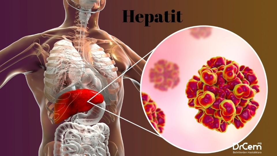Hepatit görseli - DrCem hastalık rehberi